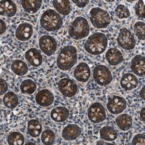 Anti-GGCT antibody produced in rabbit 