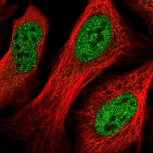 Anti-GID8 antibody produced in rabbit 