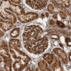 Anti-GIGYF1 antibody produced in rabbit 