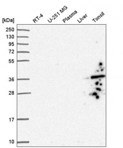 Anti-GIMAP1 antibody produced in rabbit 