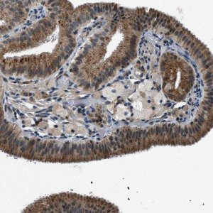 Anti-GINM1 antibody produced in rabbit HPA017210-100UL