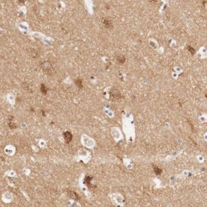 Anti-GIT1 antibody produced in rabbit 