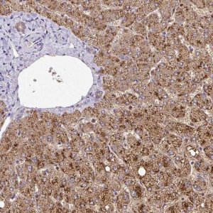 Anti-GK antibody produced in rabbit 