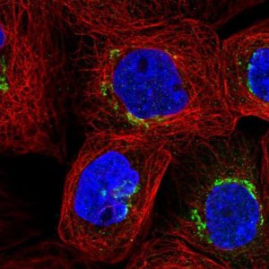 Anti-GLB1 antibody produced in rabbit 