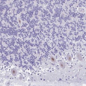 Anti-GLB1L2 antibody produced in rabbit 