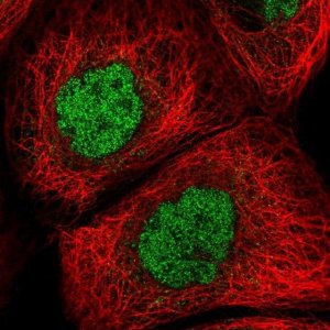 Anti-GLB1L2 antibody produced in rabbit 