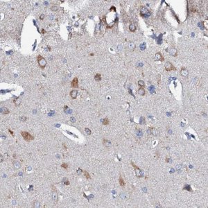 Anti-GLB1L3 antibody produced in rabbit 