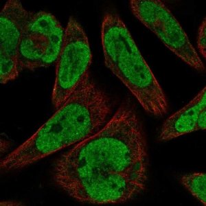 Anti-GLI1 antibody produced in rabbit 