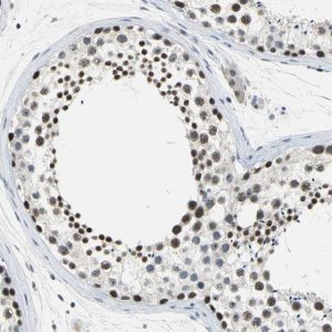 Anti-GLI3 antibody produced in rabbit 