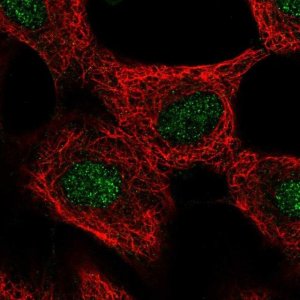 Anti-GLI4 antibody produced in rabbit 