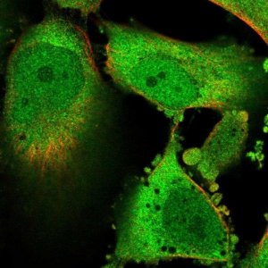 Anti-GLO1 antibody produced in rabbit HPA059791-100UL