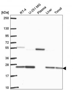 Anti-GLO1 antibody produced in rabbit HPA059791-100UL