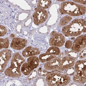 Anti-GLRX antibody produced in rabbit 