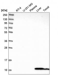 Anti-GLRX antibody produced in rabbit 
