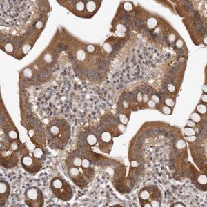 Anti-GLRX3 antibody produced in rabbit HPA028941-100UL