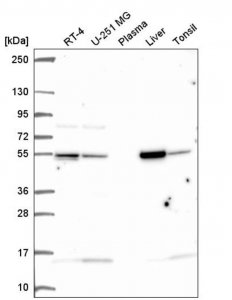 Anti-GLUD1 antibody produced in rabbit 
