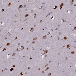 Anti-GLYATL3 antibody produced in rabbit 