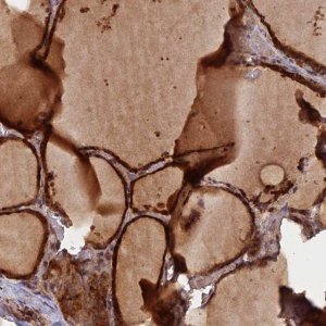 Anti-GMCL1 antibody produced in rabbit 