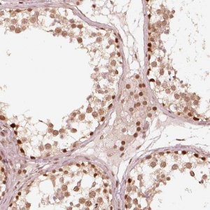 Anti-GMEB2 antibody produced in rabbit 