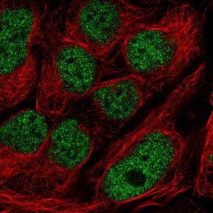 Anti-GMEB2 antibody produced in rabbit 