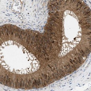 Anti-GMPPB antibody produced in rabbit 