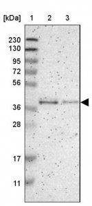 Anti-GMPPB antibody produced in rabbit 