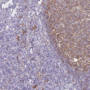 Anti-GNA11 antibody produced in rabbit 
