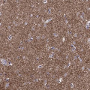 Anti-GNAL antibody produced in rabbit 