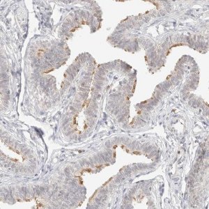 Anti-GNAS antibody produced in rabbit 
