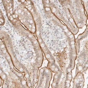 Anti-GNAS antibody produced in rabbit HPA027478-100UL