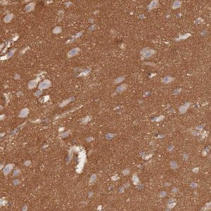 Anti-GNB4 antibody produced in rabbit HPA040736-100UL