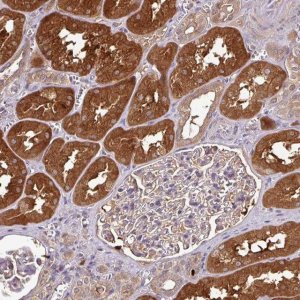 Anti-GNPDA1 antibody produced in rabbit 