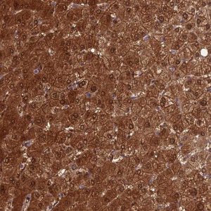 Anti-GNPNAT1 antibody produced in rabbit HPA044647-100UL