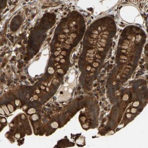 Anti-GOPC antibody produced in rabbit 