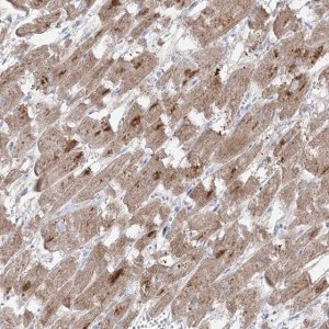 Anti-GPAT2 antibody produced in rabbit 