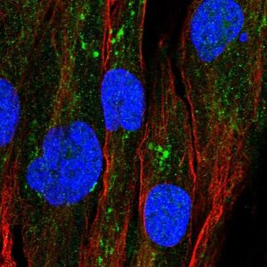 Anti-GPAT2 antibody produced in rabbit 