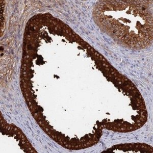 Anti-GPATCH1 antibody produced in rabbit 