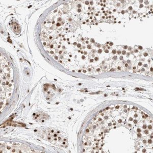 Anti-GPATCH2 antibody produced in rabbit 