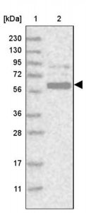 Anti-GPATCH2 antibody produced in rabbit 