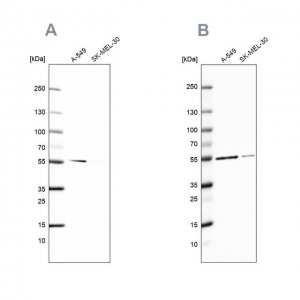 Anti-GPI antibody produced in rabbit 