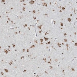 Anti-GPR107 antibody produced in rabbit 