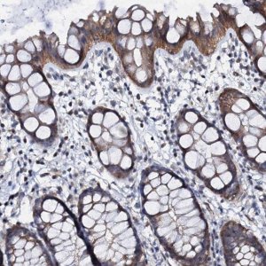 Anti-GPR176 antibody produced in rabbit 