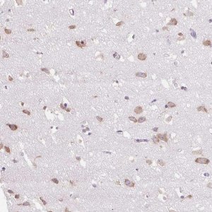 Anti-GPR45 antibody produced in rabbit 