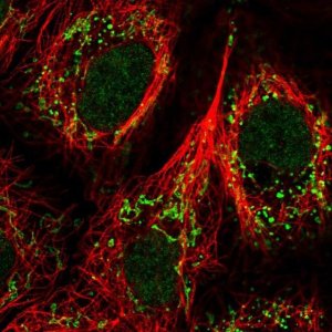 Anti-GPR87 antibody produced in rabbit 