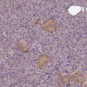 Anti-GPRC5D antibody produced in rabbit 