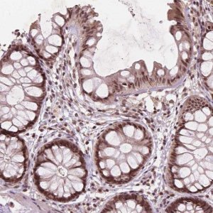 Anti-GPS2 antibody produced in rabbit 