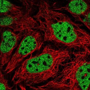 Anti-GPS2 antibody produced in rabbit 
