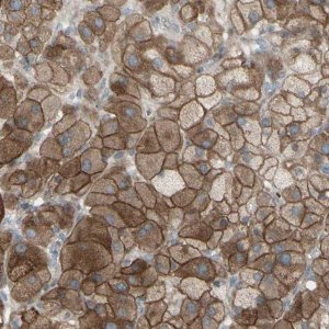 Anti-GRAMD1B antibody produced in rabbit 