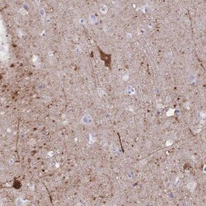 Anti-GRB7 antibody produced in rabbit 
