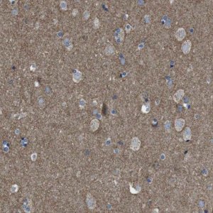 Anti-GRIK2 antibody produced in rabbit 